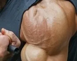 Luego de usar el Sigma