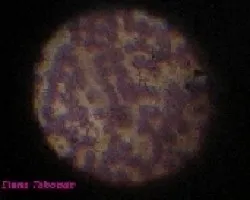 globulos rojos, microscopio optico a 40x