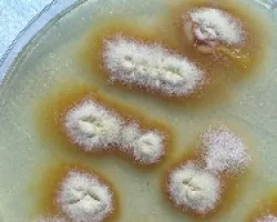 Cultico de Trichophyton tonsurans