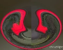 Abstracto